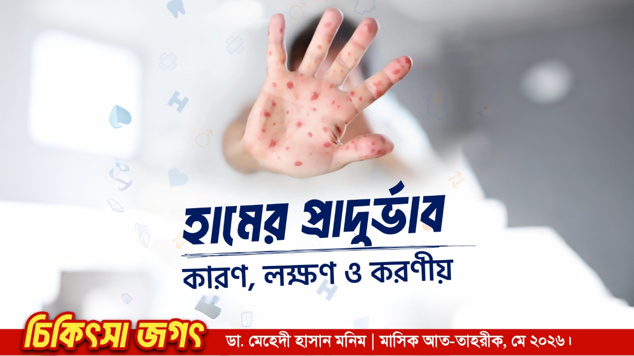 হামের প্রাদুর্ভাব : কারণ, লক্ষণ ও করণীয়
